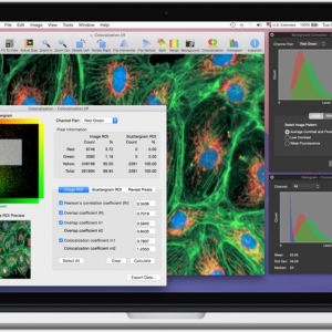 CoLocalizer Pro for mac 3.0.2 – 共定位定量分析软件 最新绿化版